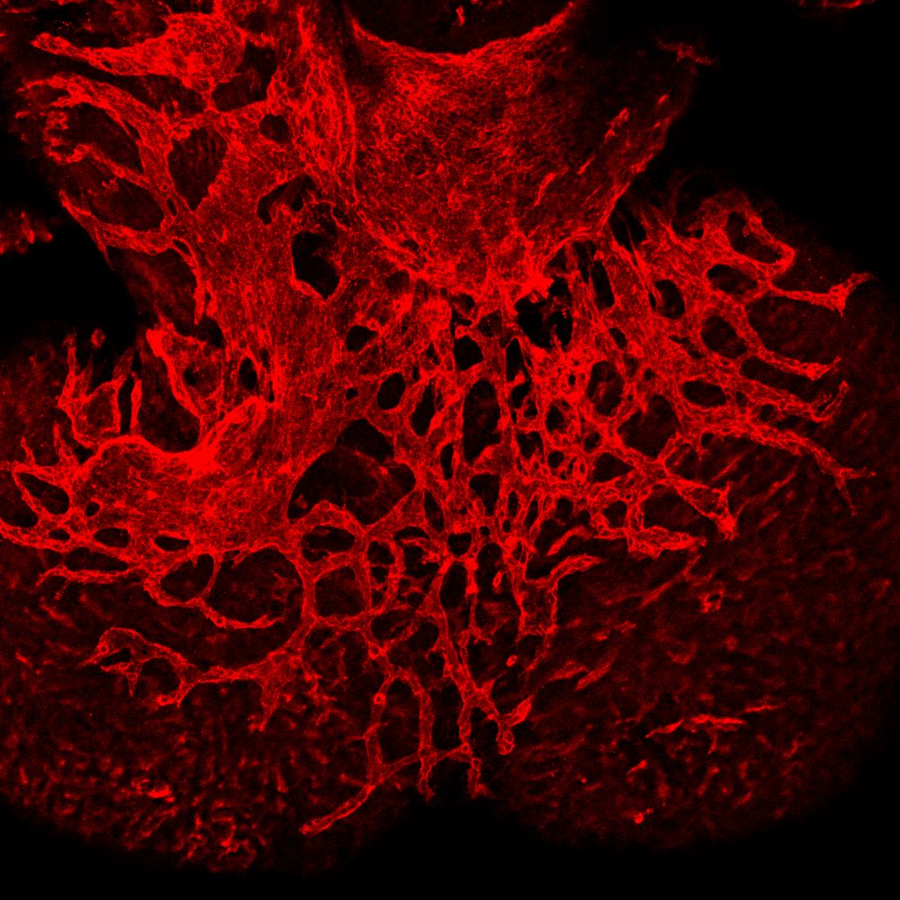 Branching blood vessels in the heart by Dr Joaquim Vieira.jpg