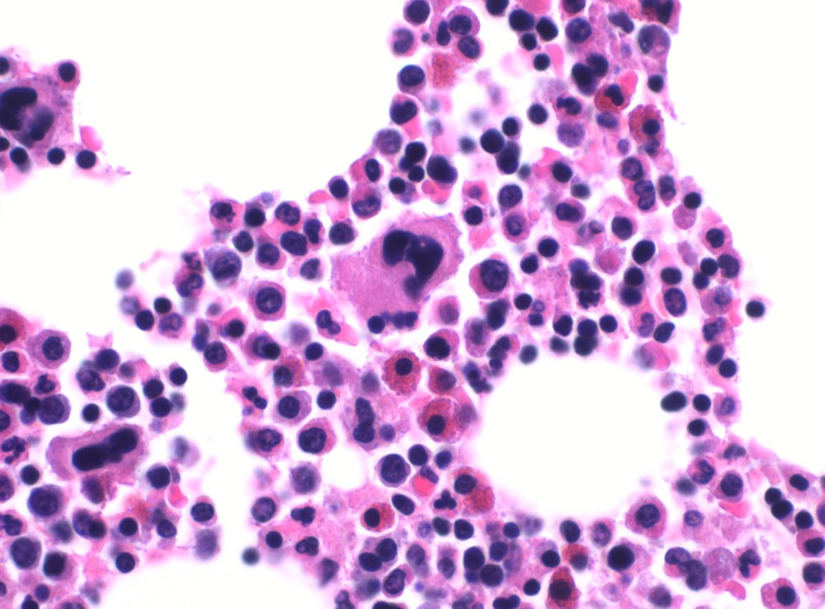 Trilineage hematopoiesis.jpg