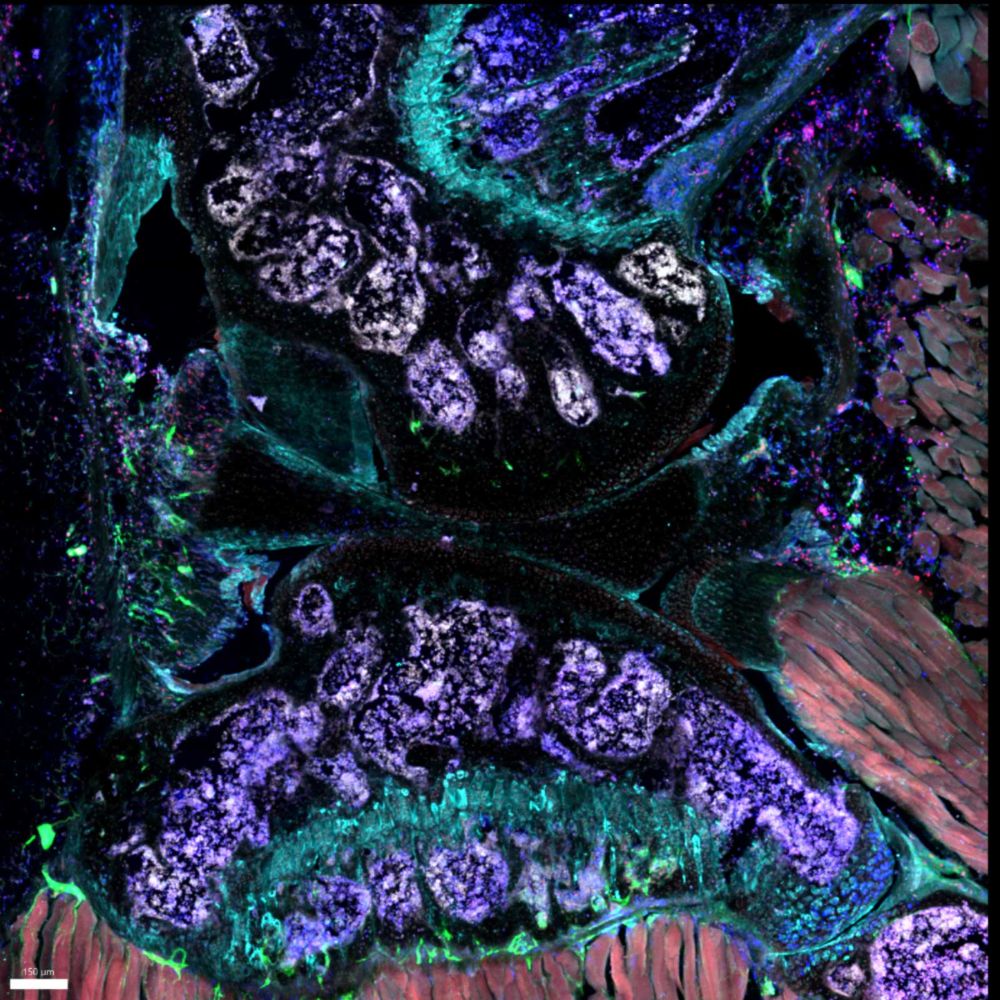 Confocal imaging of antigen-induced arthritis in mouse knee.