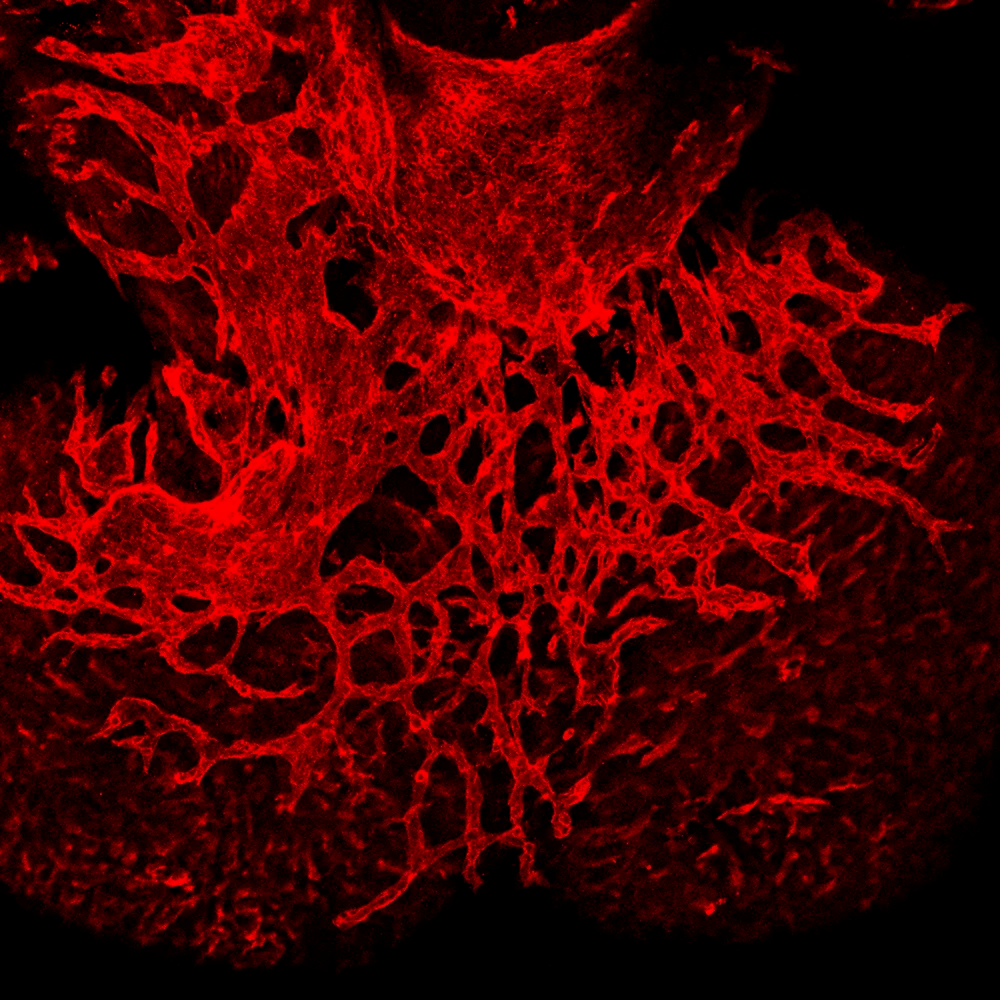 Branching blood vessels in the heart