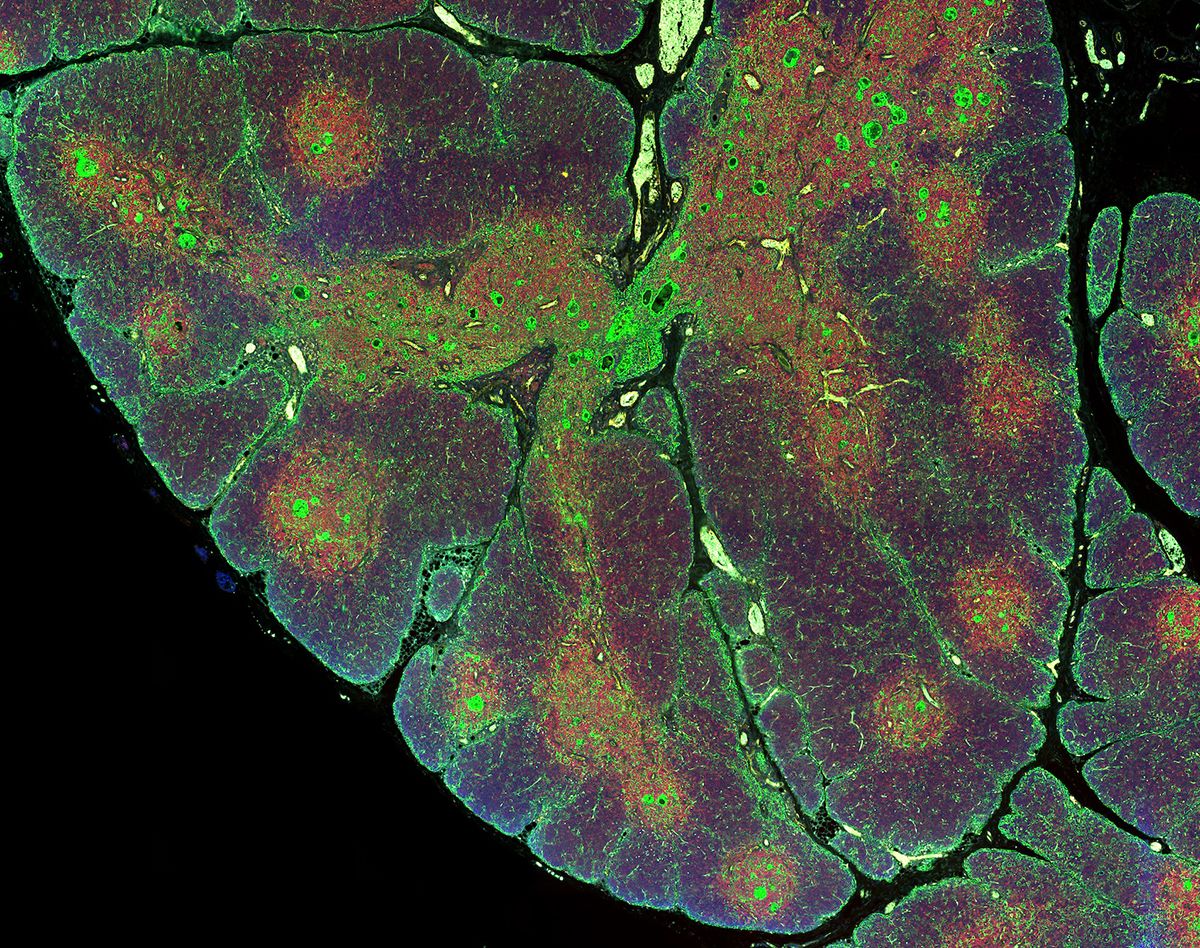 Human thymus section