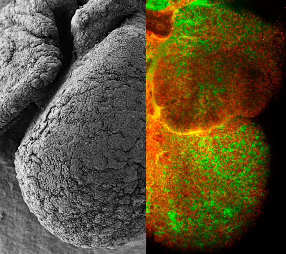 Developing heart of a mouse embryo captured using an electron microscope