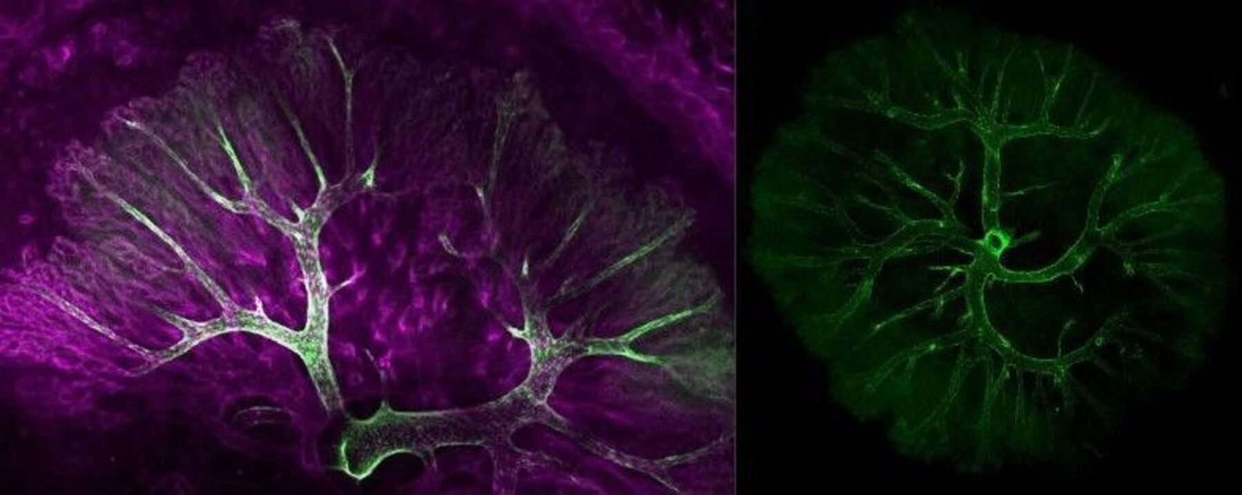 Placental blood vessels
