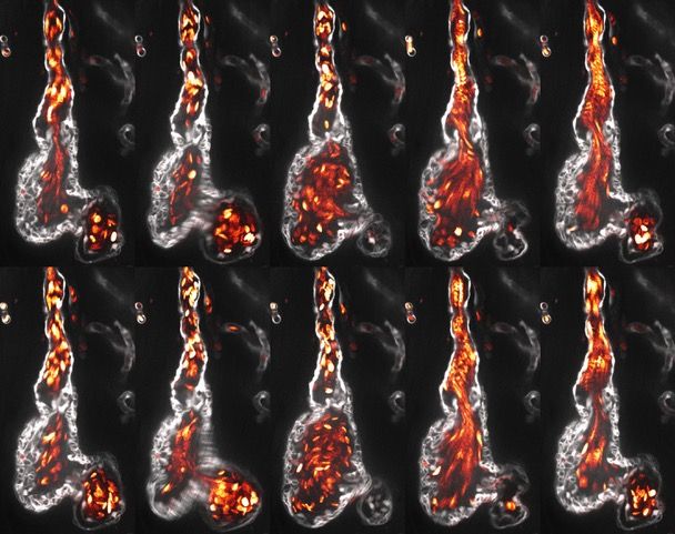 Toby Andrews_Heartbeat_small.jpeg