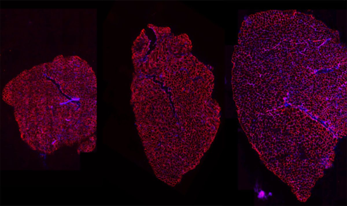 AR cooperates with SMAD4 to maintain skeletal muscle homeostasis - Carlo Rinaldi.jpg