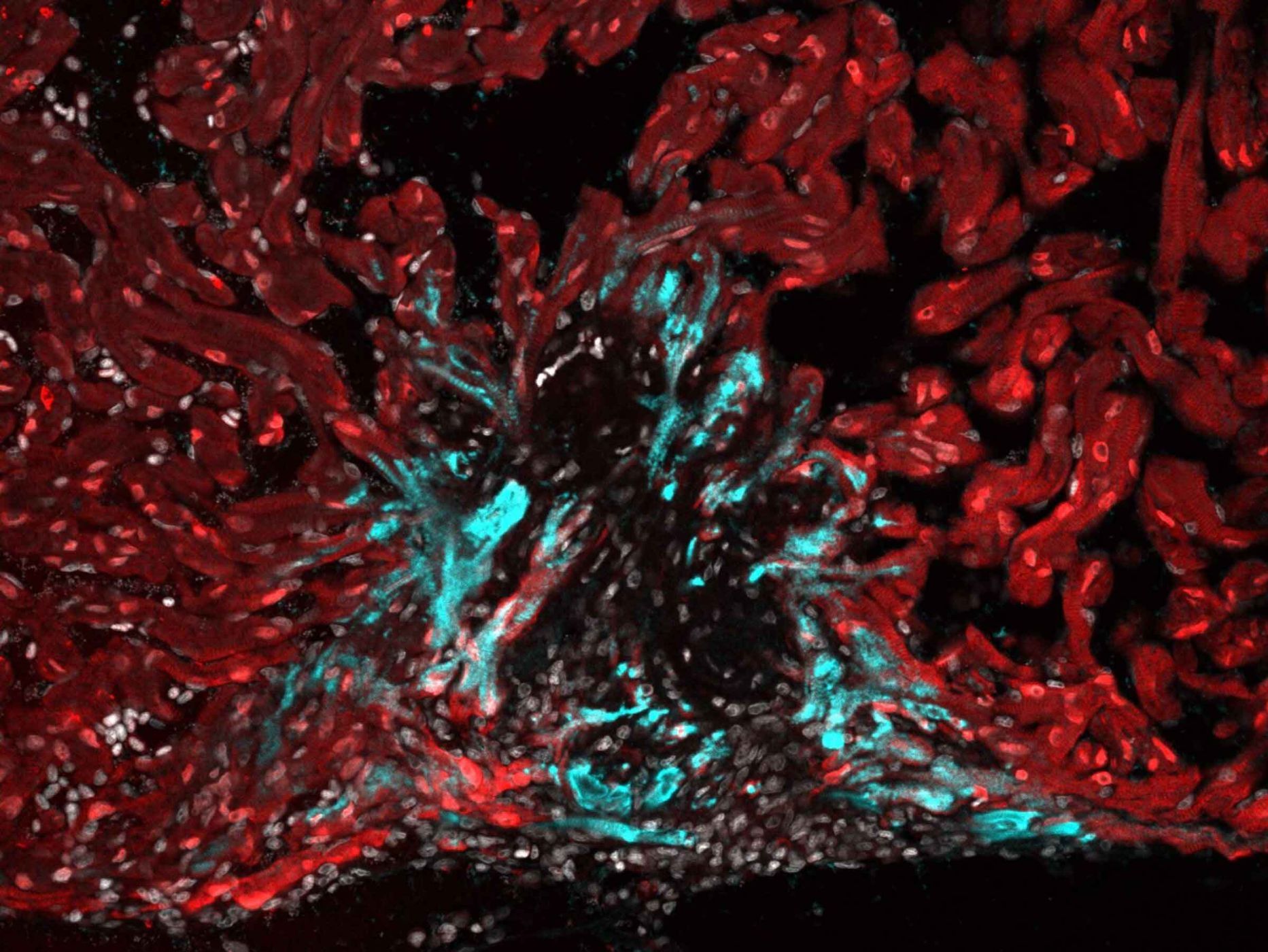 Redifferentiating cardiomyocytes (cyan), closing in on a wound.