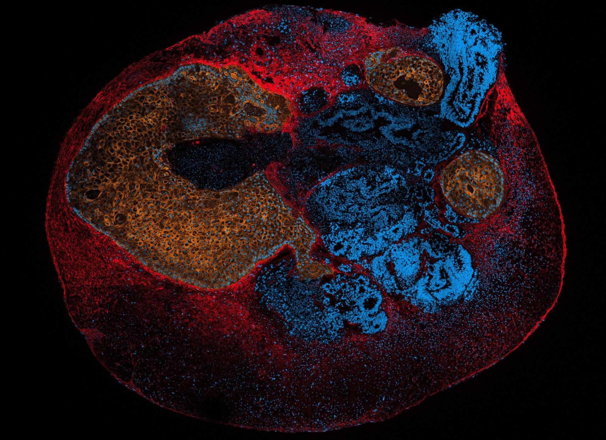 Liver organoid visualised by live multi-colour fluorescence confocal imaging