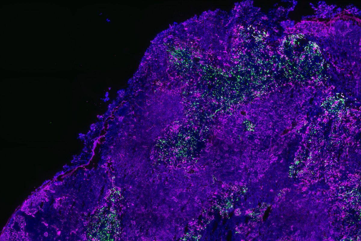 Mouse thymus section