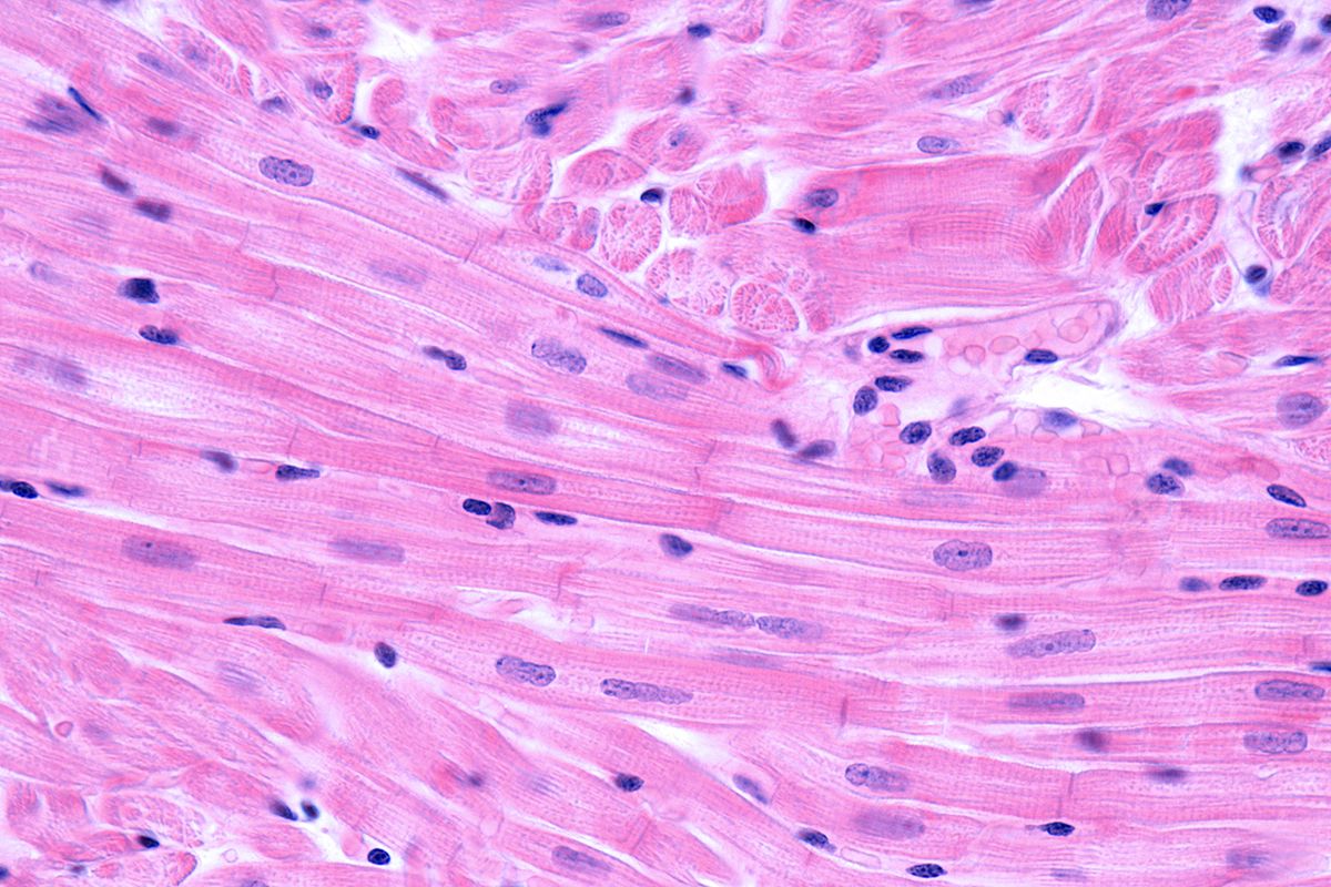 Striated muscle fibers of the heart myocardium stained with H&E. The cardiac myocytes have a central single or double nucleus, peripheral striated myofibrils and are joined by intercalated disks.