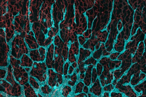 Forming lymphatic vessels in the mouse dermis. Lymphatic vessels are cyan and blood vessels are red.jpg