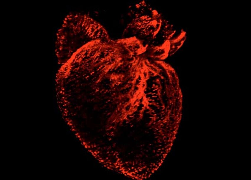 Cardiology Heart Scan